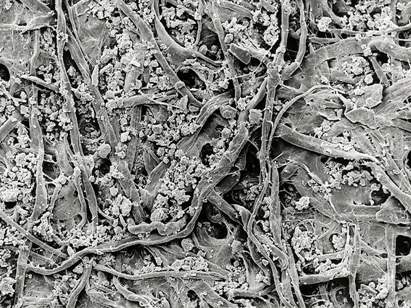 SEM image of air filter paper intercepting particulate pollutants